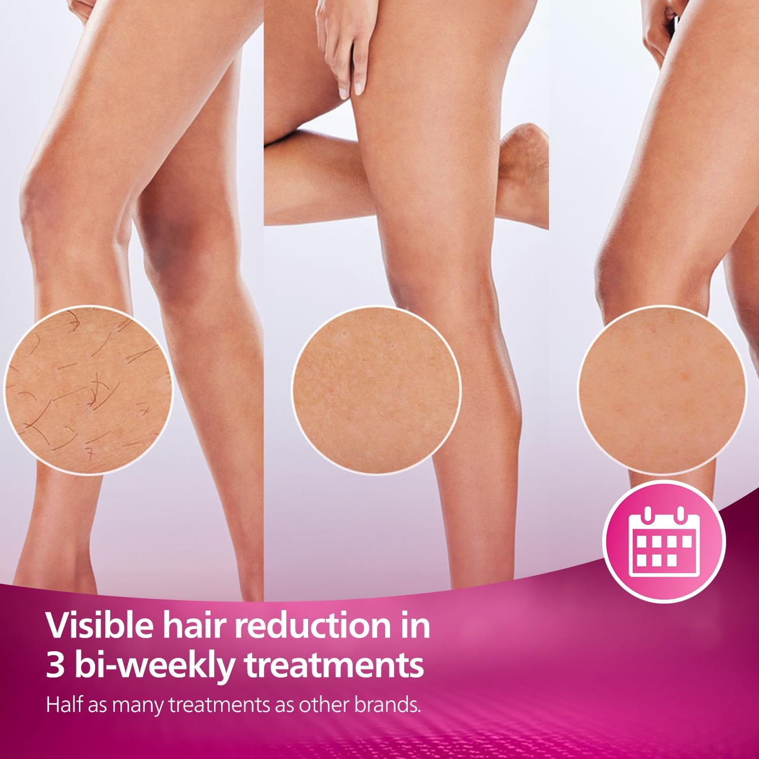 Philips Lumea Advanced IPL - Hair removal device - BRI921/60