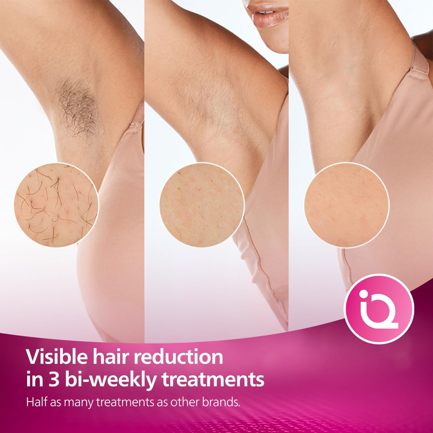 Philips Lumea Advanced IPL - Hair removal device - BRI921/60